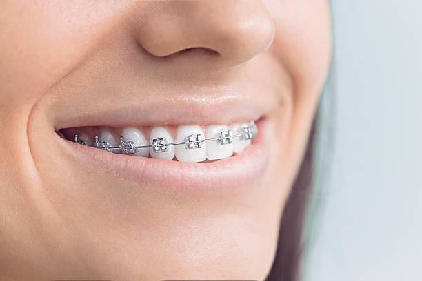 Best Full Mouth Reconstruction  in Sunset, LA